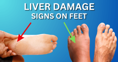 Signs of Liver Damage on Feet